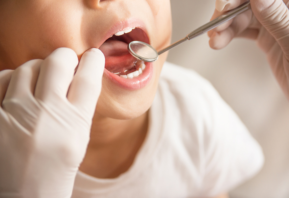 一般的な歯科診療 / 小児歯科